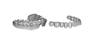 Full Dentures without Teeth